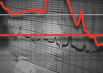 We can and may preserve unemployment beneath 4%, says our survey of high economists